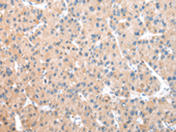 Rabbit Polyclonal Antibody to WDR18