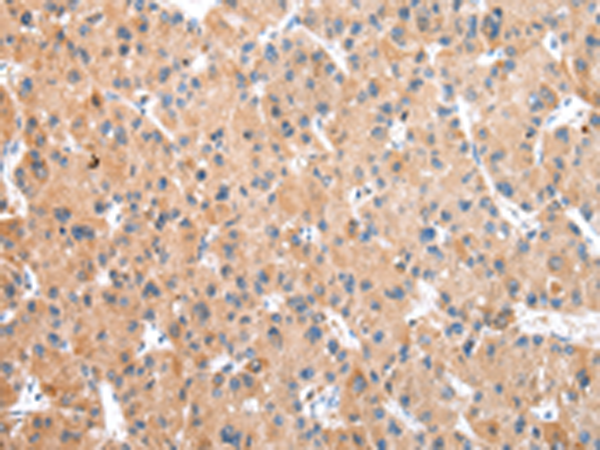 Rabbit Polyclonal Antibody to WDR19