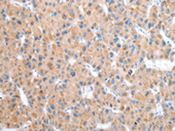 Rabbit Polyclonal Antibody to CFAP52