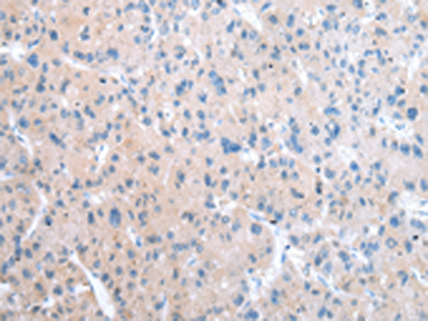 Rabbit Polyclonal Antibody to WDR61