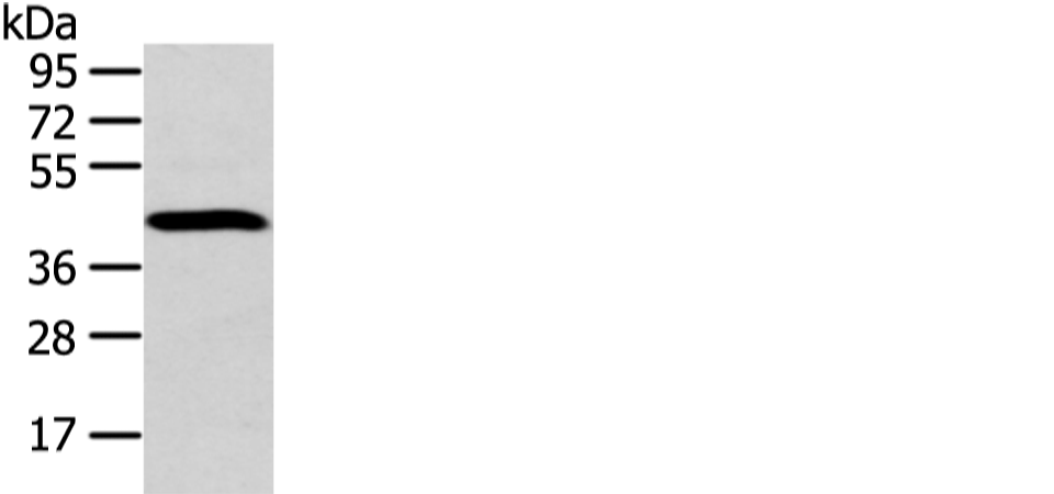 Rabbit Polyclonal Antibody to DCAF7