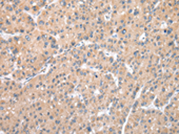 Rabbit Polyclonal Antibody to DPH7