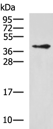 Rabbit Polyclonal Antibody to WDR77