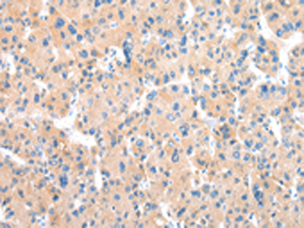 Rabbit Polyclonal Antibody to WFDC5