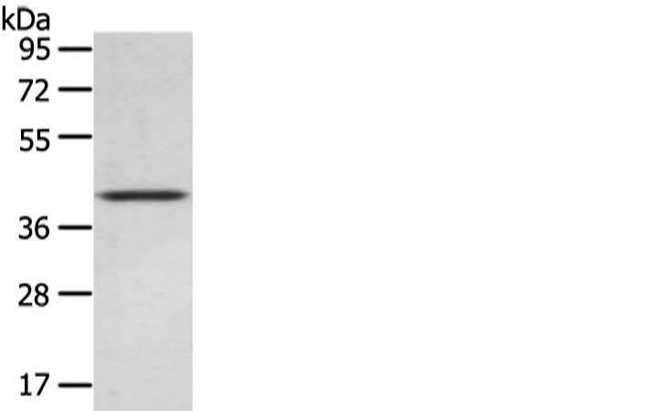 Rabbit Polyclonal Antibody to WIF1