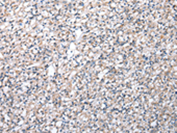 Rabbit Polyclonal Antibody to FKBPL