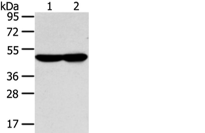Rabbit Polyclonal Antibody to WSB1