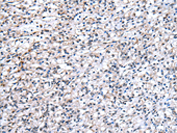 Rabbit Polyclonal Antibody to XAB2