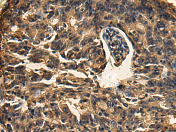 Rabbit Polyclonal Antibody to XAGE2