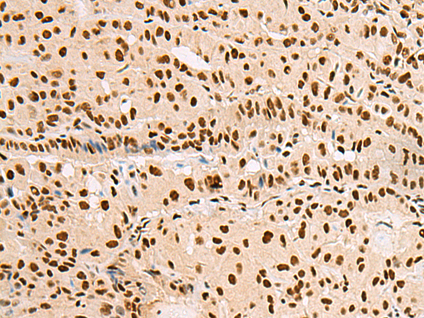 Rabbit Polyclonal Antibody to XRCC4