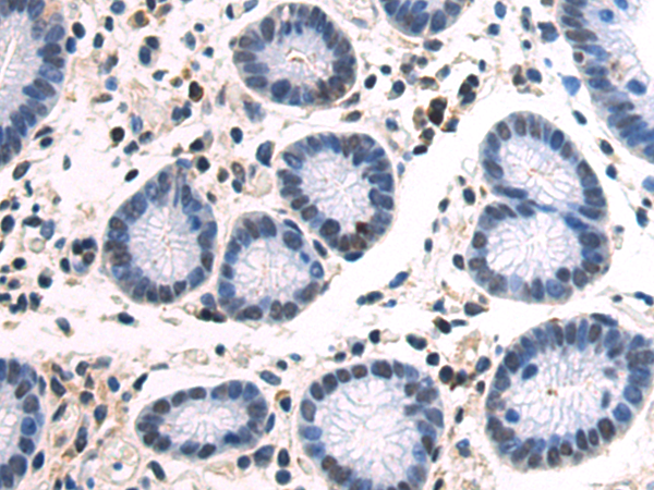 Rabbit Polyclonal Antibody to YY1AP1