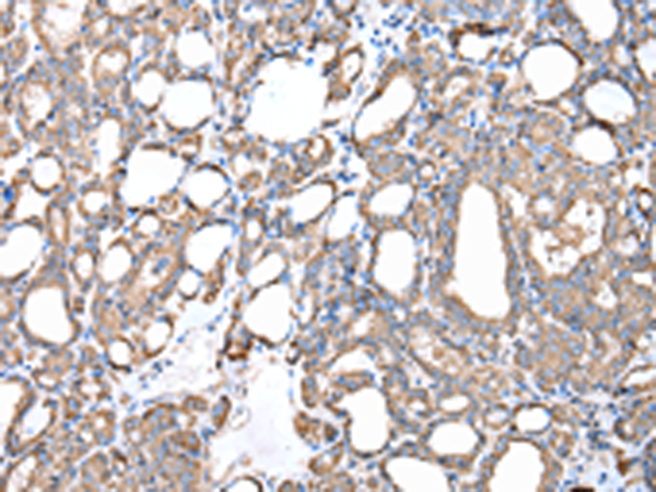 Rabbit Polyclonal Antibody to ZDHHC20