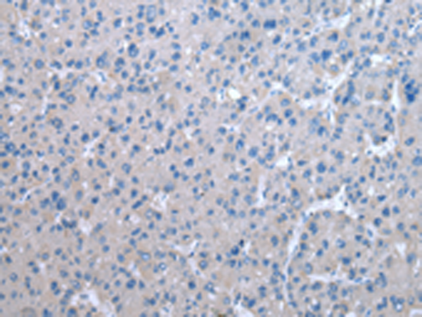 Rabbit Polyclonal Antibody to ZFAND3