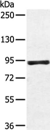 Rabbit Polyclonal Antibody to ZFP28