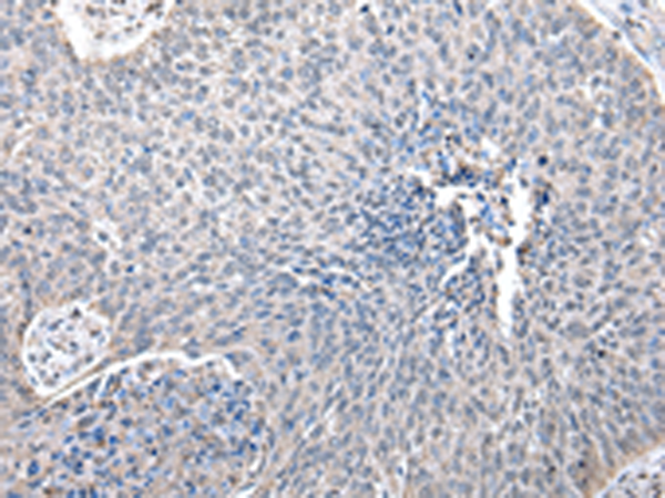Rabbit Polyclonal Antibody to ZFP64