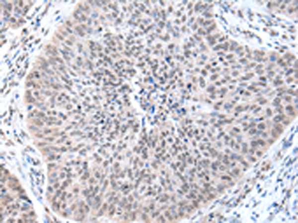 Rabbit Polyclonal Antibody to ZFP91