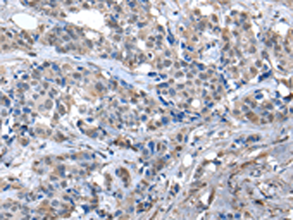 Rabbit Polyclonal Antibody to ZFP2