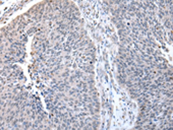 Rabbit Polyclonal Antibody to ZNF23