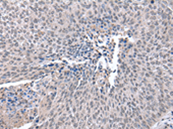Rabbit Polyclonal Antibody to ZNF239