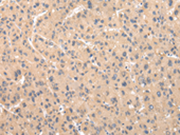 Rabbit Polyclonal Antibody to ZNF268