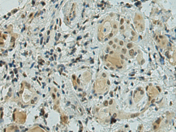 Rabbit Polyclonal Antibody to ZBTB20