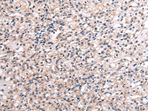 Rabbit Polyclonal Antibody to RNF115