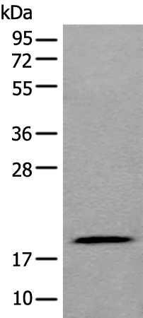 Rabbit Polyclonal Antibody to ZNHIT1