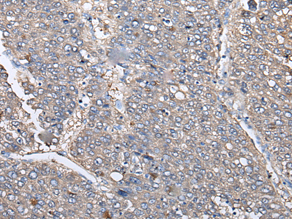 Rabbit Polyclonal Antibody to KRT73