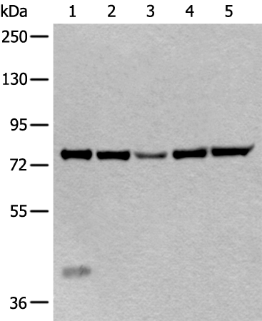 Rabbit Polyclonal Antibody to ATF6B