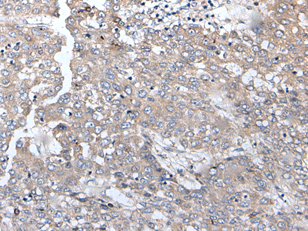 Rabbit Polyclonal Antibody to BRMS1L