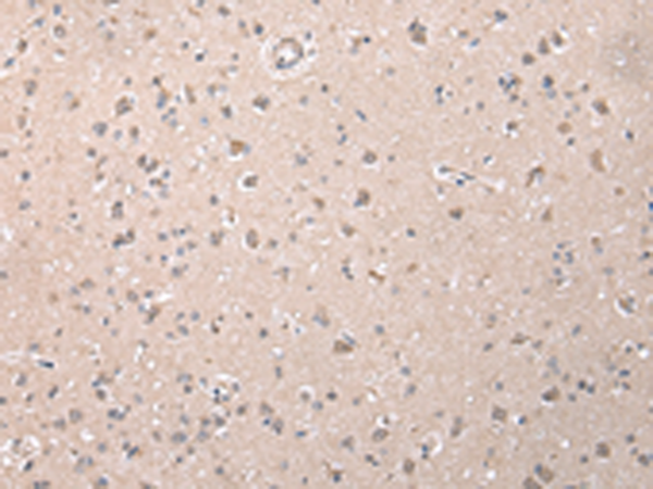 Rabbit Polyclonal Antibody to ZCCHC9