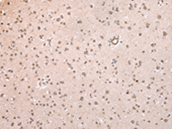 Rabbit Polyclonal Antibody to POLR2K