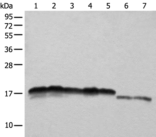 Rabbit Polyclonal Antibody to NDUFB11