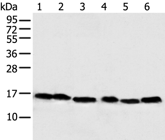 Rabbit Polyclonal Antibody to NDUFB6