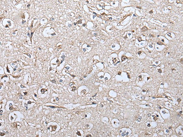 Rabbit Polyclonal Antibody to NDUFB5