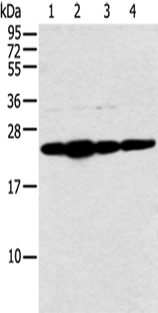 Rabbit Polyclonal Antibody to NDUFB9