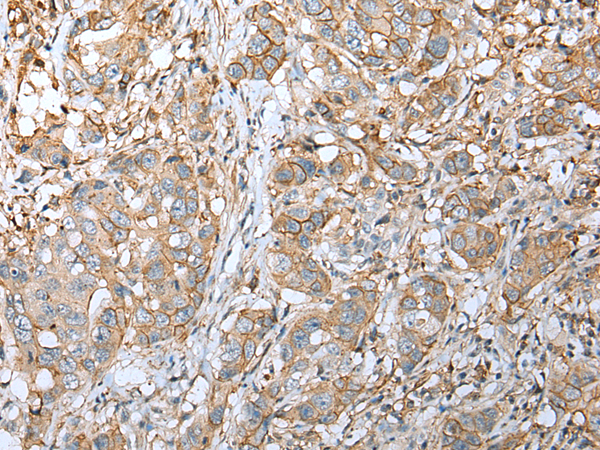 Rabbit Polyclonal Antibody to FNDC3B