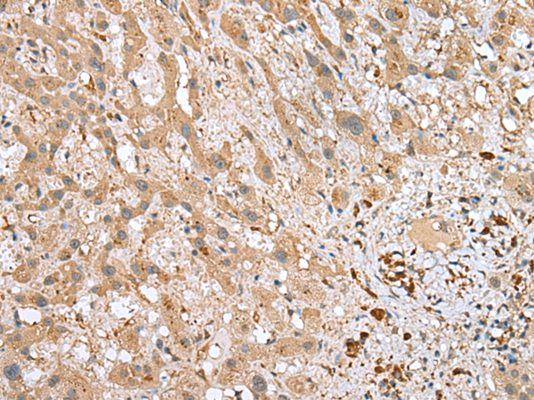 Rabbit Polyclonal Antibody to RPS21