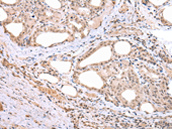 Rabbit Polyclonal Antibody to ARL17A/ARL17B