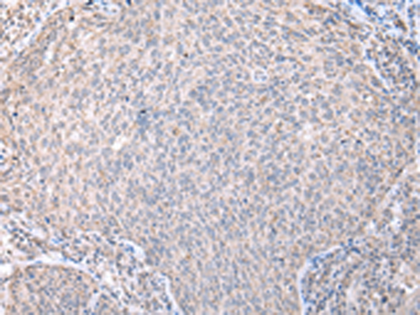 Rabbit Polyclonal Antibody to DYNLL2