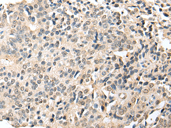 Rabbit Polyclonal Antibody to RABL2B