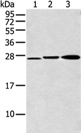 Rabbit Polyclonal Antibody to DCXR