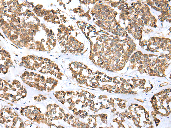 Rabbit Polyclonal Antibody to FMO5
