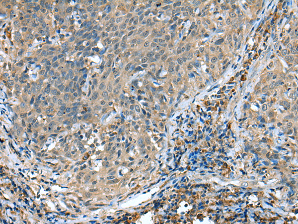 Rabbit Polyclonal Antibody to HIF1AN