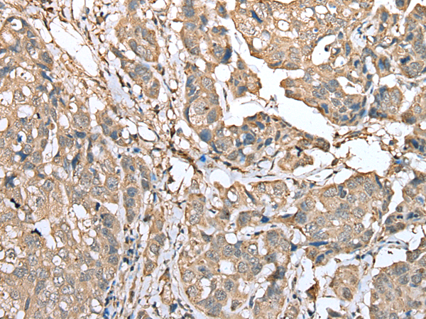 Rabbit Polyclonal Antibody to HIF1A