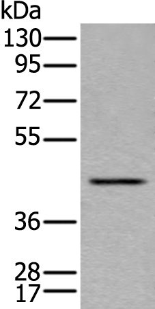Rabbit Polyclonal Antibody to LMNTD1