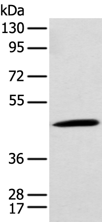 Rabbit Polyclonal Antibody to KYAT1