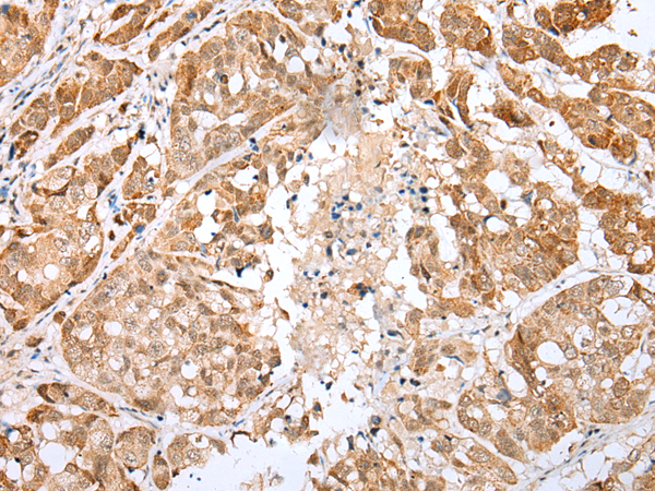 Rabbit Polyclonal Antibody to CRYZL1