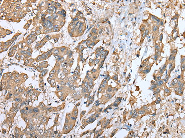 Rabbit Polyclonal Antibody to KRT222