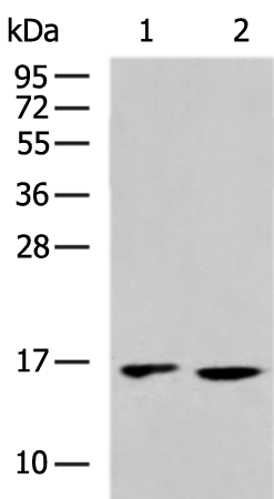 Rabbit Polyclonal Antibody to RPS15A
